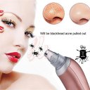 Blackhead Removal Electric Facial Pore Cleaner Acne Remover Facial Cleanser